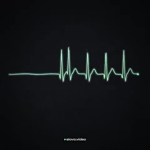ECG